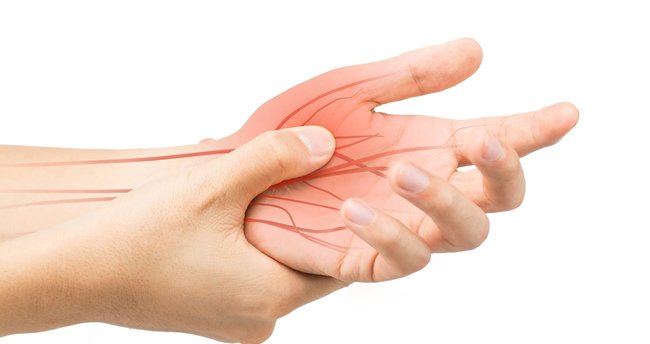 Karpal Tünel Sendromu